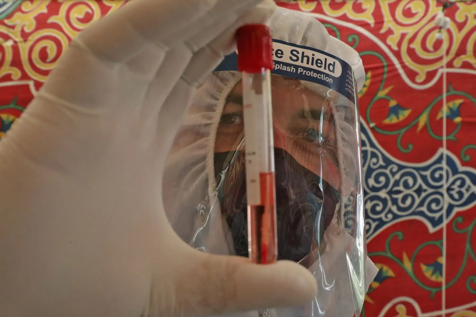 La descripción de este método aún preliminar, desarrollado para la detección temprana de cinco tipo comunes de cáncer, se publica en la revista Nature Communications. Foto: AFP