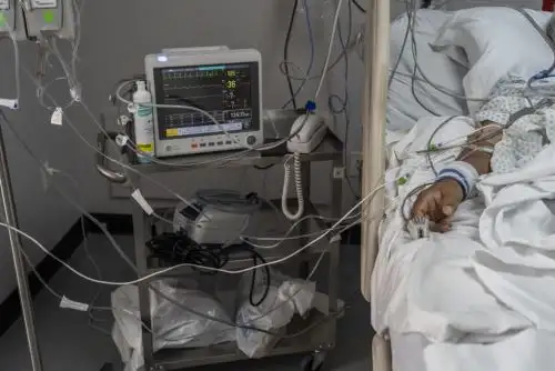 Un paciente yace en la cama conectado a un equipo médico en la unidad de cuidados intensivos covid-19 en el United Memorial Medical Center en Houston, Texas. Foto:AFP