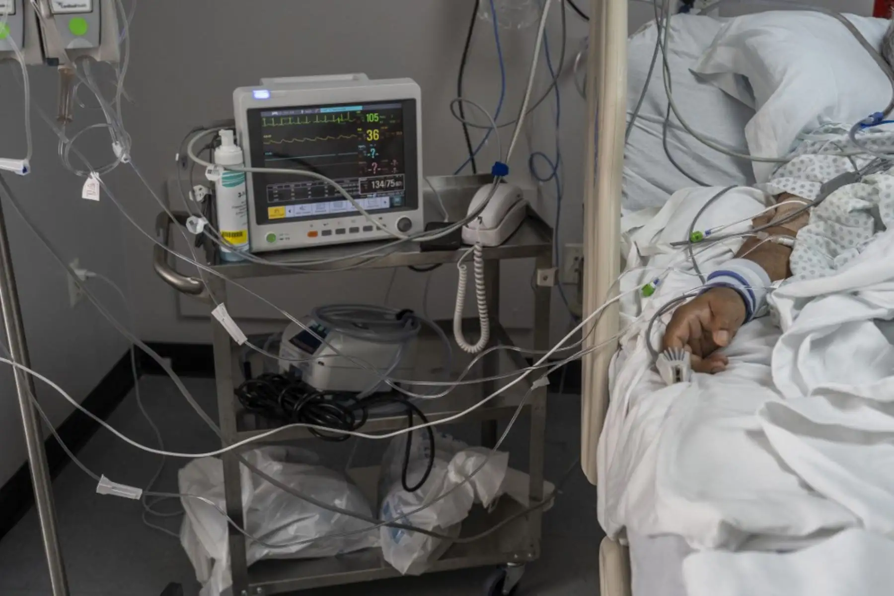 Un paciente yace en la cama conectado a un equipo médico en la unidad de cuidados intensivos covid-19 en el United Memorial Medical Center en Houston, Texas. Foto:AFP