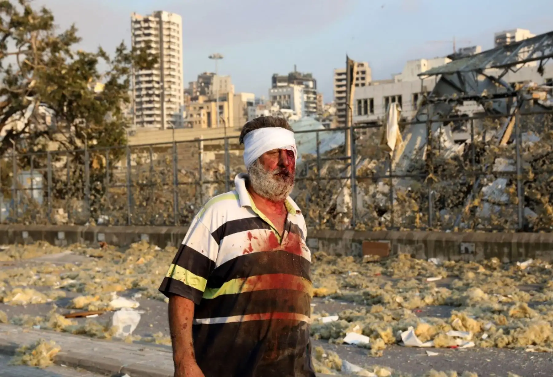 Un hombre herido camina cerca de la escena de una explosión en Beirut el 4 de agosto de 2020. Foto: AFP