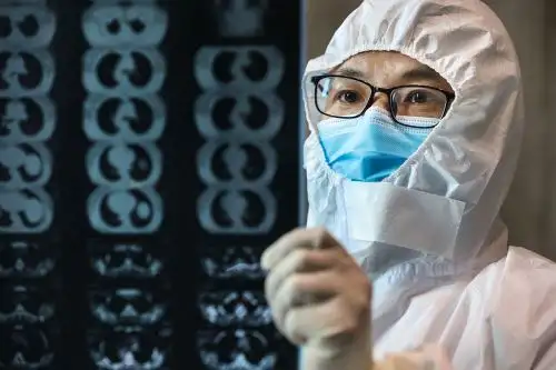 Según la Organización Mundial de la Salud (OMS), el periodo de la incubación de la peste es de entre 3 y 7 días, y tiene una tasa de mortalidad del 30%. Foto: AFP