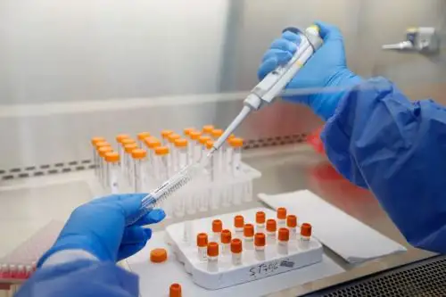 La prueba antigénica es útil en la primera semana, su efectividad es de 60 % o 70 %, pero el PCR tiene mayor utilidad porque detecta más estructuras del virus, asegura infectólogo. Foto: Minsa