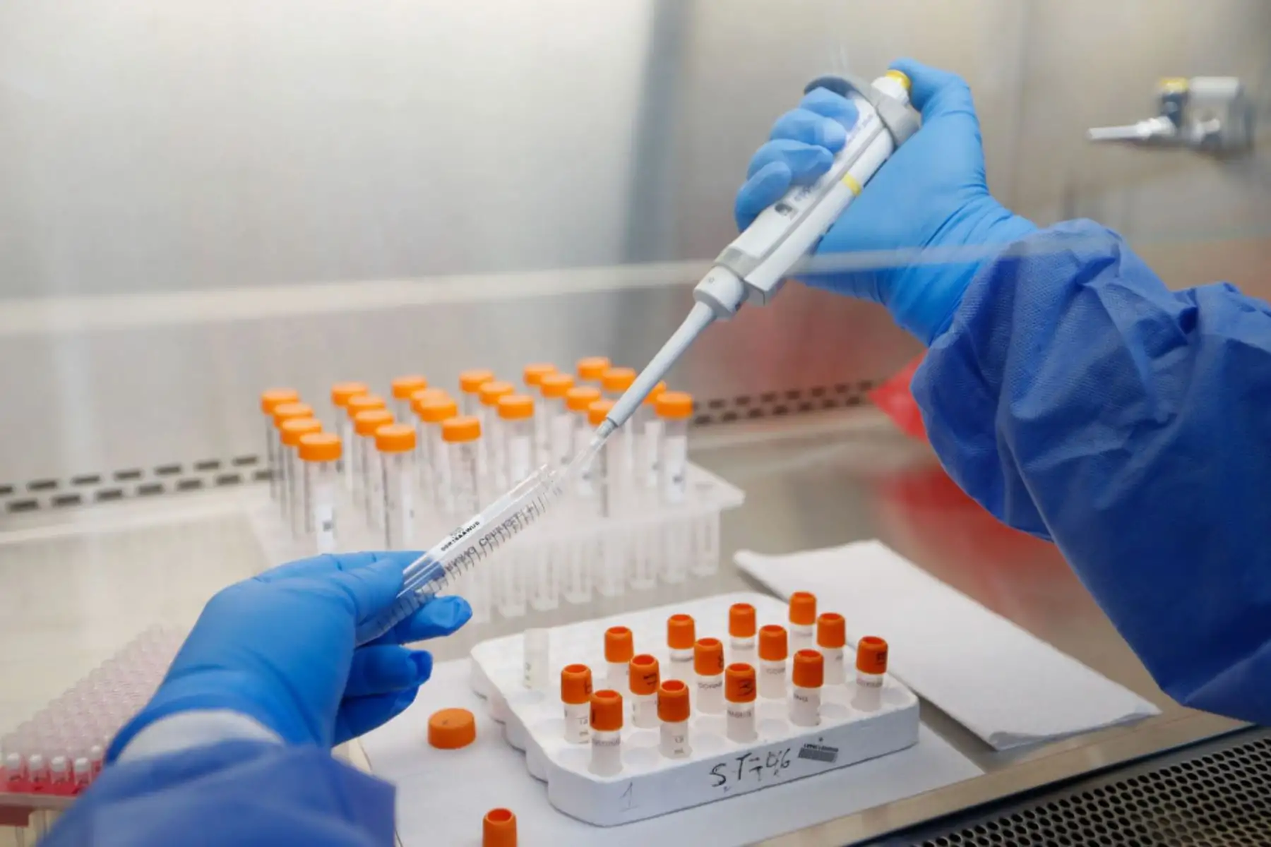 La prueba antigénica es útil en la primera semana, su efectividad es de 60 % o 70 %, pero el PCR tiene mayor utilidad porque detecta más estructuras del virus, asegura infectólogo. Foto: Minsa