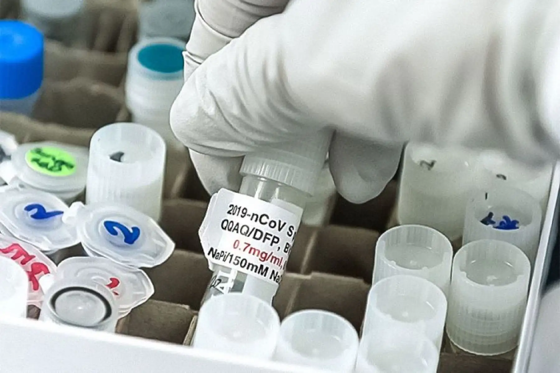 Coronavirus: Oxford y Johnson & Johnson solicitan realizar ensayos clínicos en Perú Foto: archivo