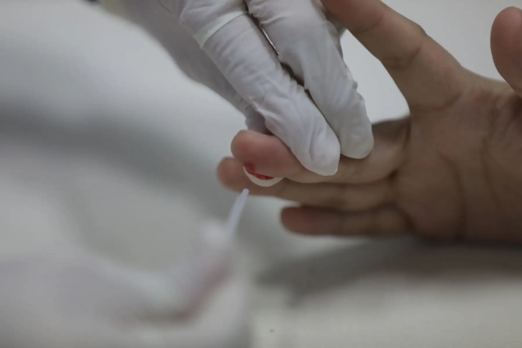 El COP Arenales cuenta con equipamiento y personal especializado que se encargará de realizar la detección precoz y atención oportuna para el tratamiento de cáncer de cuello uterino, mama, colon, próstata y otros tipos de enfermedades oncológicas.
Foto: Essalud