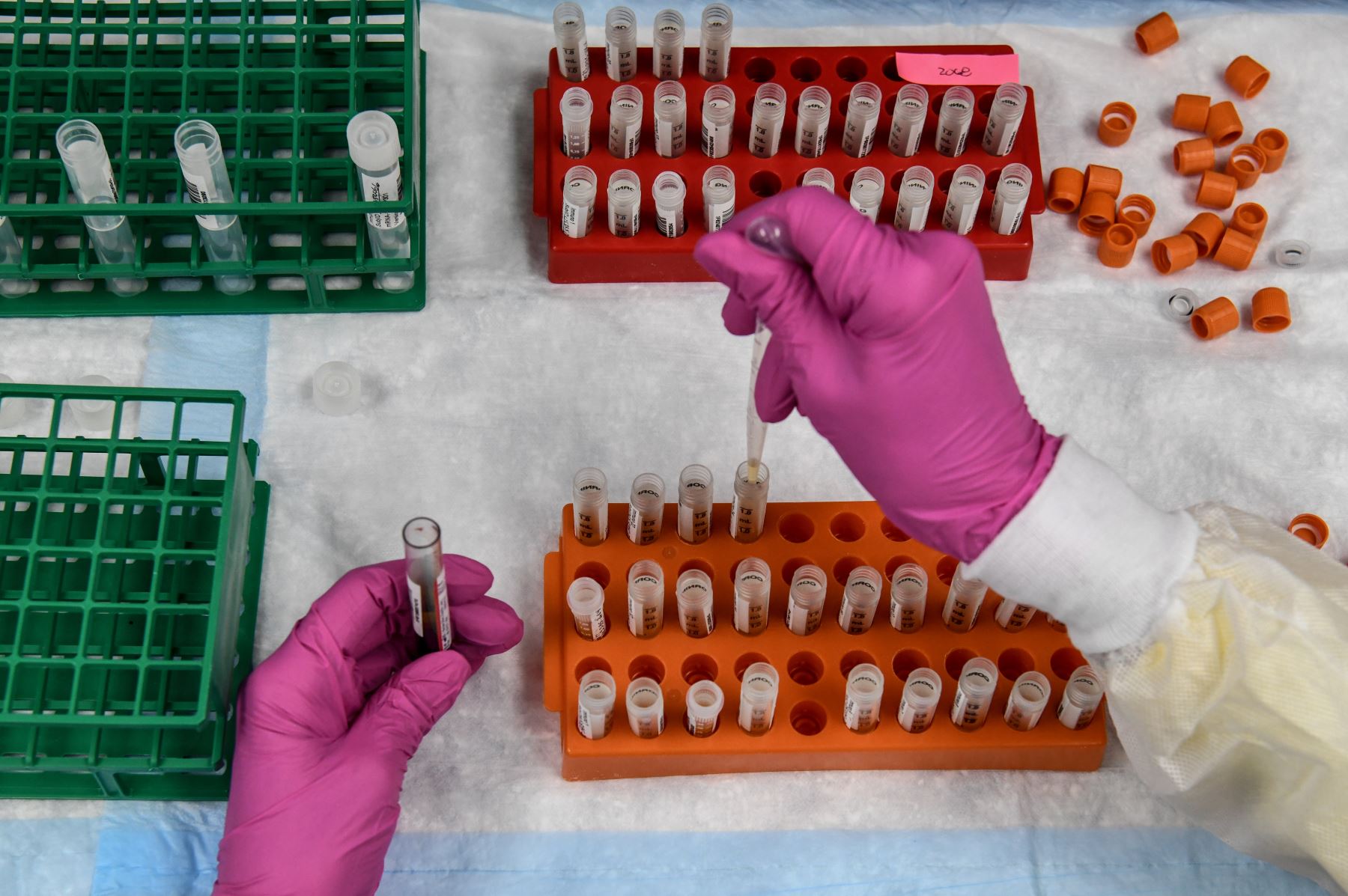 La farmacéutica AstraZeneca suspende los ensayos de su vacuna por presentar problemas de seguridad con un paciente. Foto: AFP