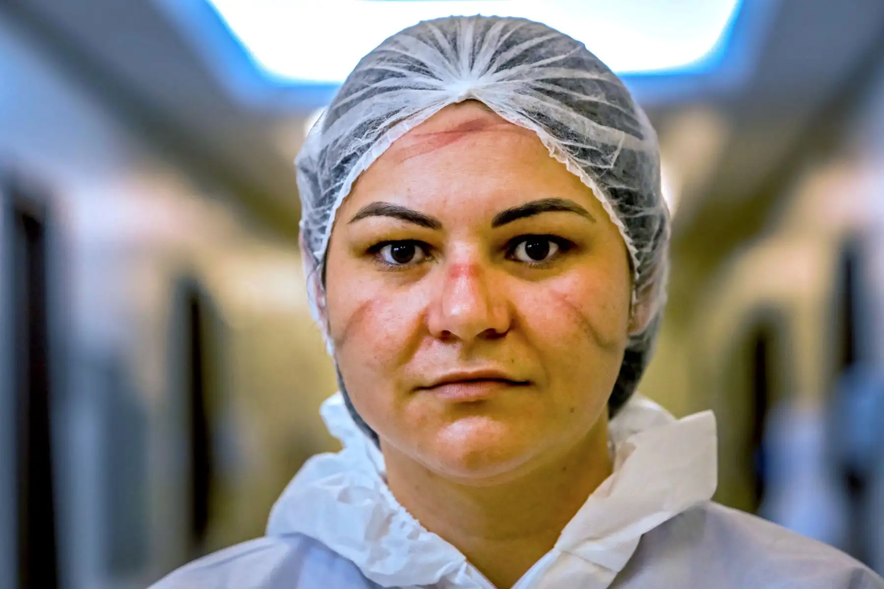 La enfermera brasileña Mayara Colin, de 31 años, posa para una fotografía que muestra los hematomas en la cara por el uso de equipo de protección durante un descanso entre turnos en la Unidad de Cuidados Intensivos del Hospital Santa Casa de Misericordia en Porto Alegre, Brasil. Foto: AFP