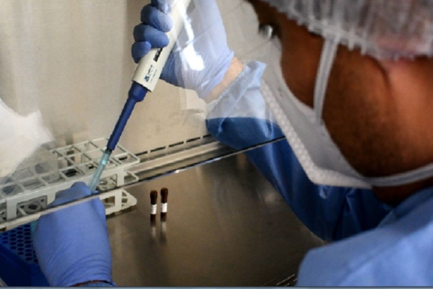 En Perú se han procesado muestras (moleculares y serológicas o rápidas) para 4 millones 92,566 personas por covid-19. Foto: ANDINA/Difusión