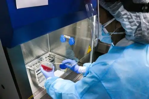 El Ministerio de Salud distribuirá alrededor de 300,000 pruebas moleculares a 22 regiones del país que cuentan con laboratorio especializado, a fin de intensificar la vigilancia epidemiológica frente al covid-19 y evitar rebrotes, dado que existe un notable descenso de contagios en todo el país. ANDINA/Difusión