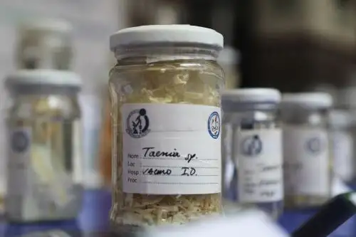 Especialistas del INS presentaron las especies de parásitos más comunes que provocan pérdida de hierro y nutrientes en el ser humano Foto: ANDINA/Difusión