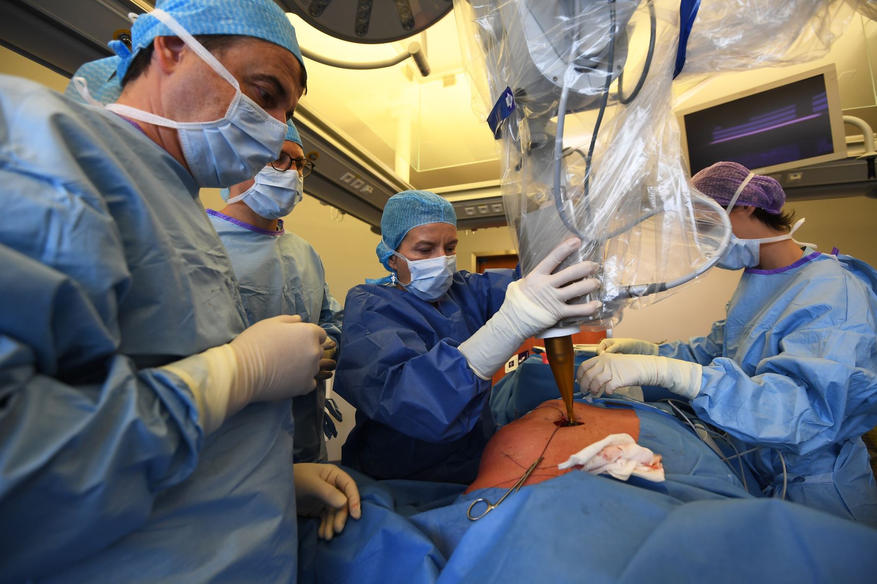 De acuerdo con el Centro Nacional de Trasplantes, en México hay 23.000 pacientes que esperan la donación de algún órgano. Foto: AFP