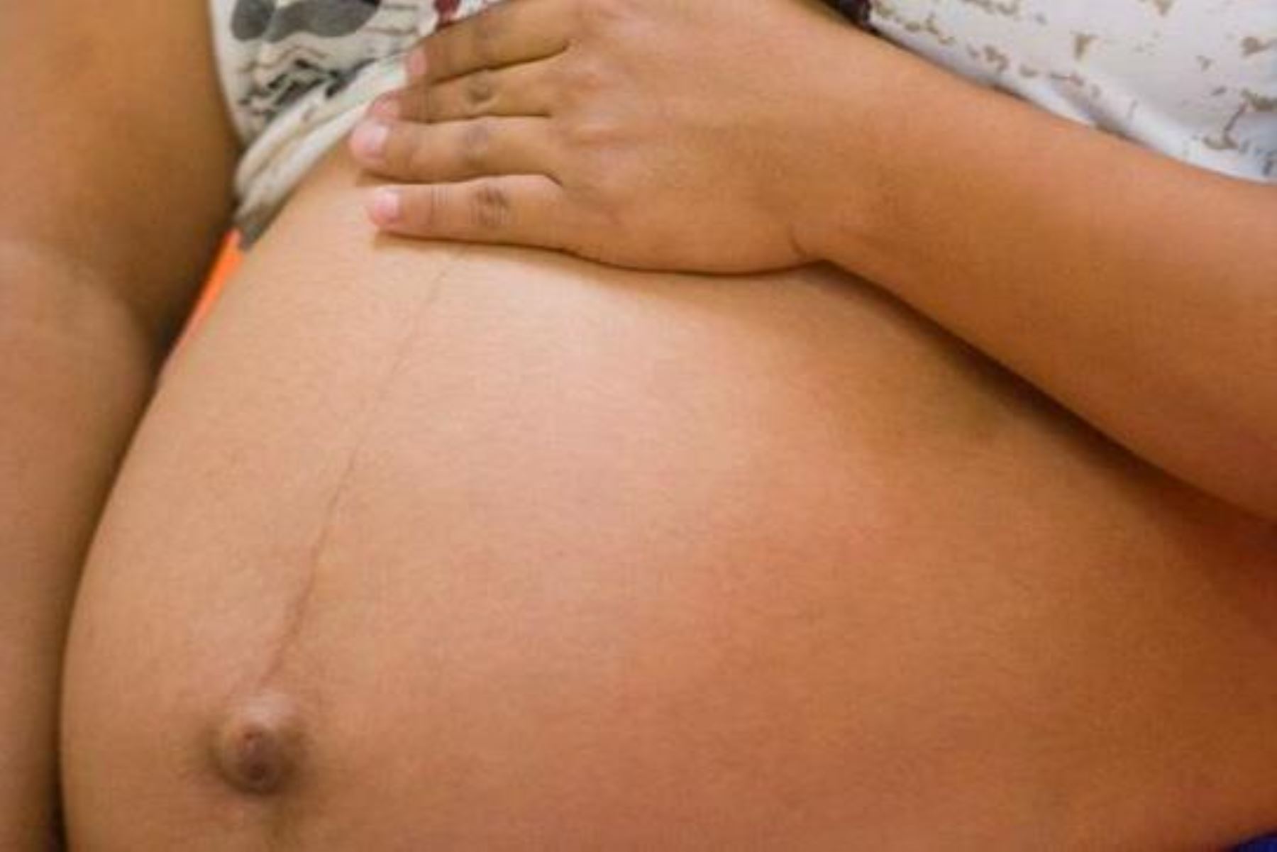 Embarazo adolescente limita posibilidades de desarrollo e impacta en salud física y mental. Foto: ANDINA/Difusión.