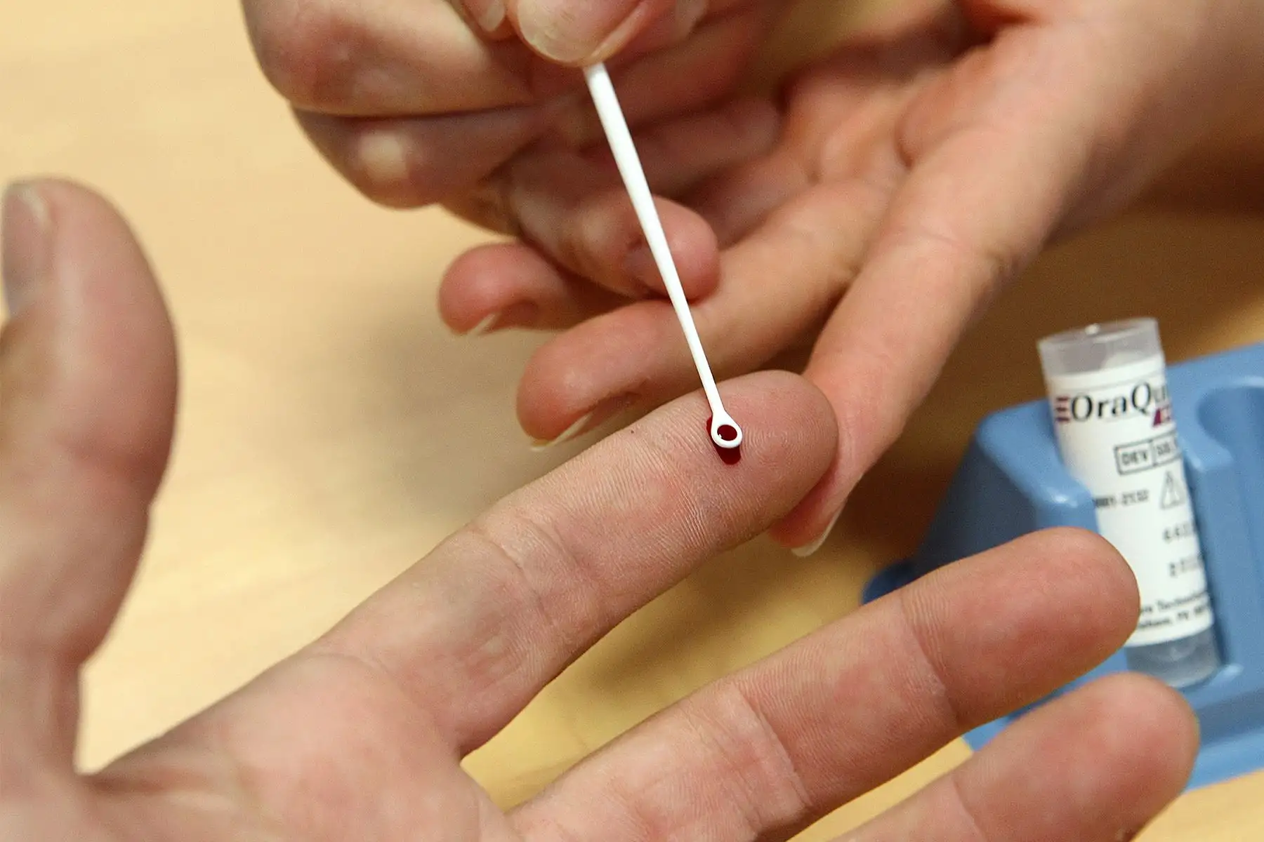 El virus de la hepatitis C es distinto de las otras dos cepas virales, A y B. Su hallazgo, que le valió el Nobel de Medicino a un trío de investigadores, permite el desarrollo de mejores pruebas diagnósticas y medicamentos. Foto: AFP.