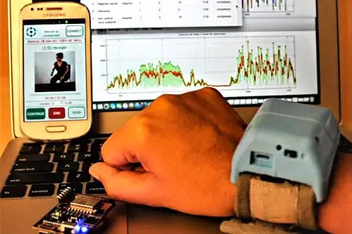 Perú desarrolla dispositivo que monitorea a distancia la rehabilitación de pacientes. Foto: ANDINA/Difusión.