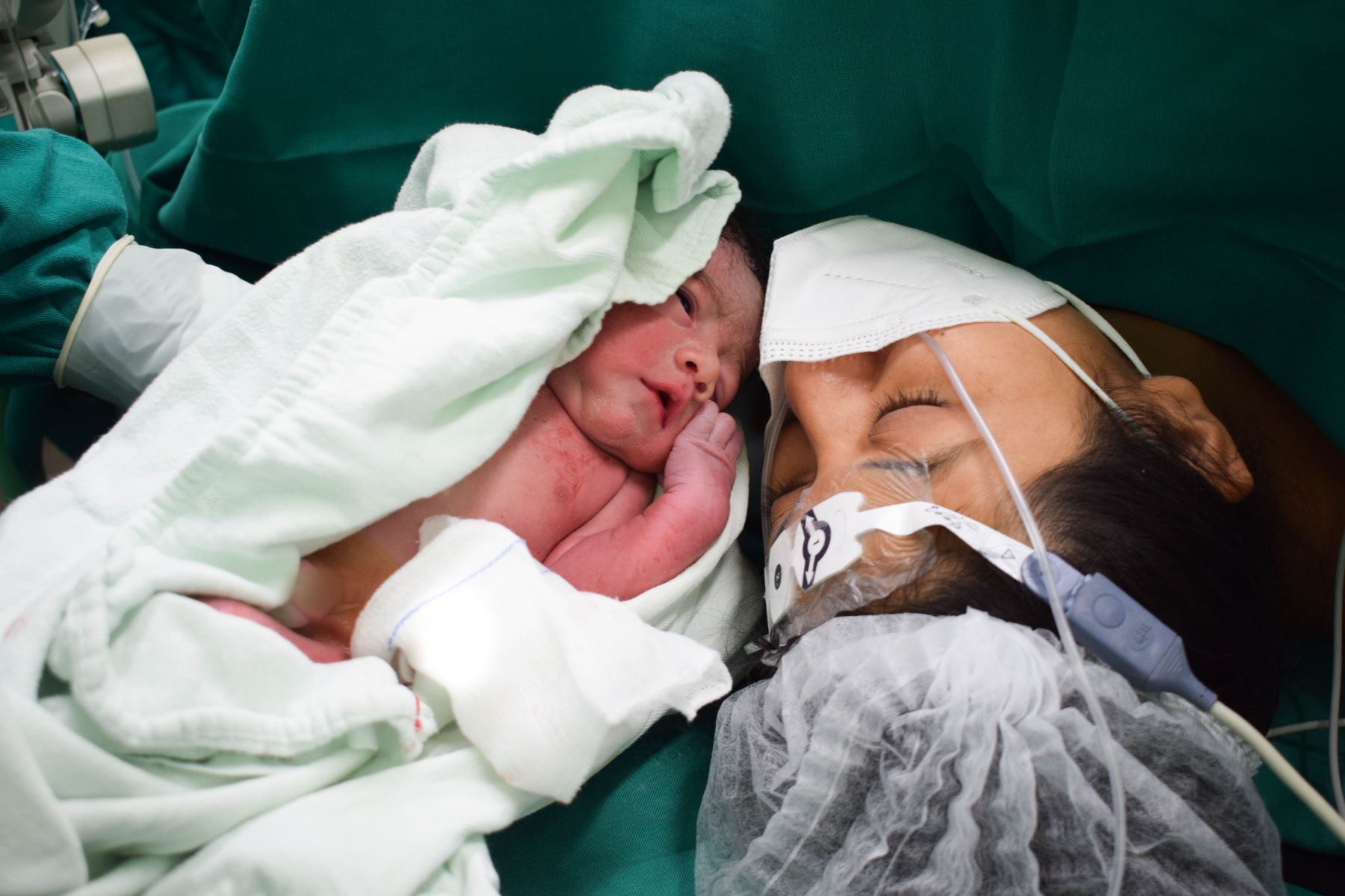 Médicos de hospital Almenara intervinieron al recién nacido tras un estudio ecográfico minucioso realizado en los controles prenatales. Foto: ANDINA/EsSalud