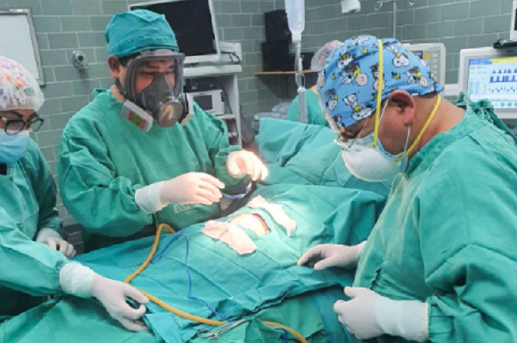 En una delicada intervención quirúrgica, médicos del Hospital Nacional Ramiro Prialé Prialé del Seguro Social de Salud en Huancayo extirparon con éxito un tumor abdominal en un bebé de 3 meses de edad. Foto: EsSalud