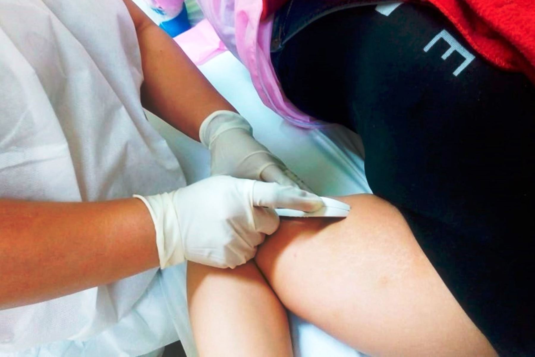 Embarazo adolescente: INSN Breña coloca implante hormonal de manera gratuita. Foto: ANDINA/Difusión.