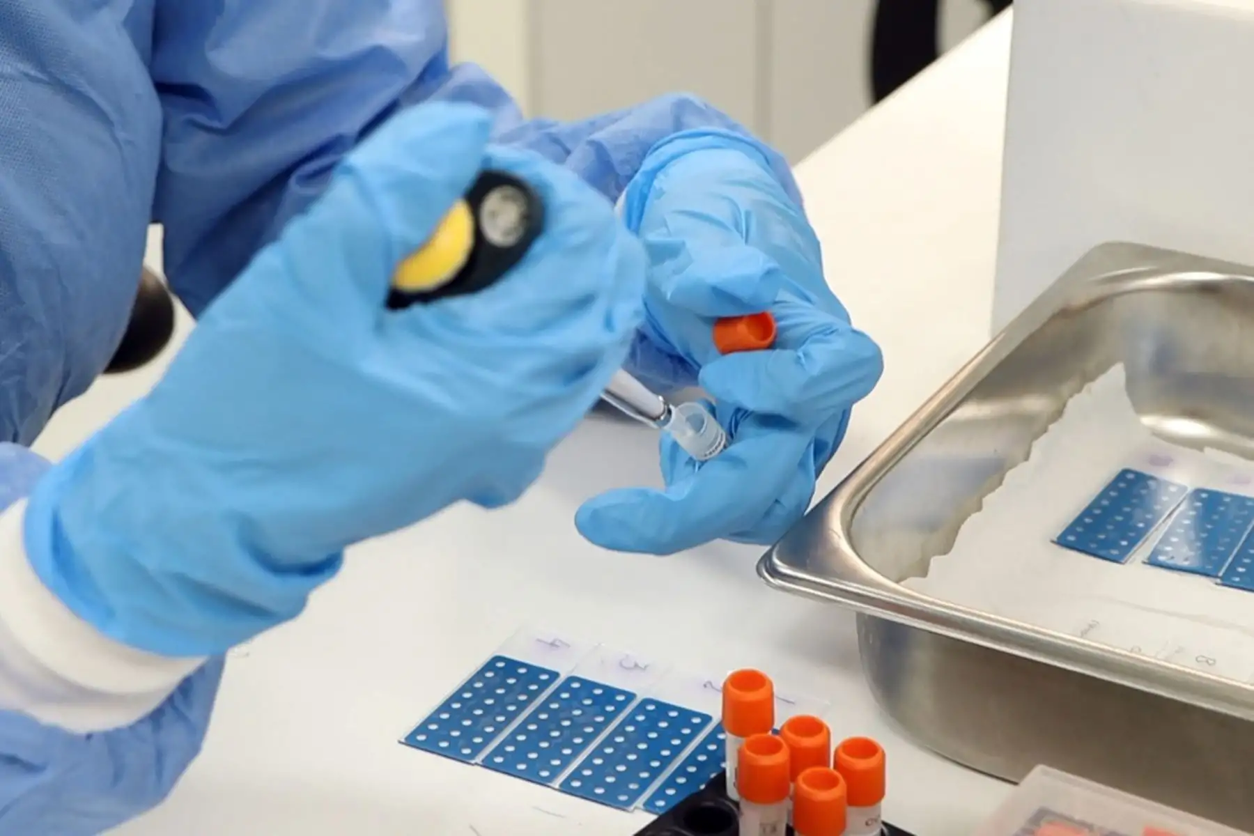 Investigadores del INS logran aislar cepa del virus SARS-CoV-2 en el Perú (Cepa Perú).
Foto:ANDINA/EsSalud