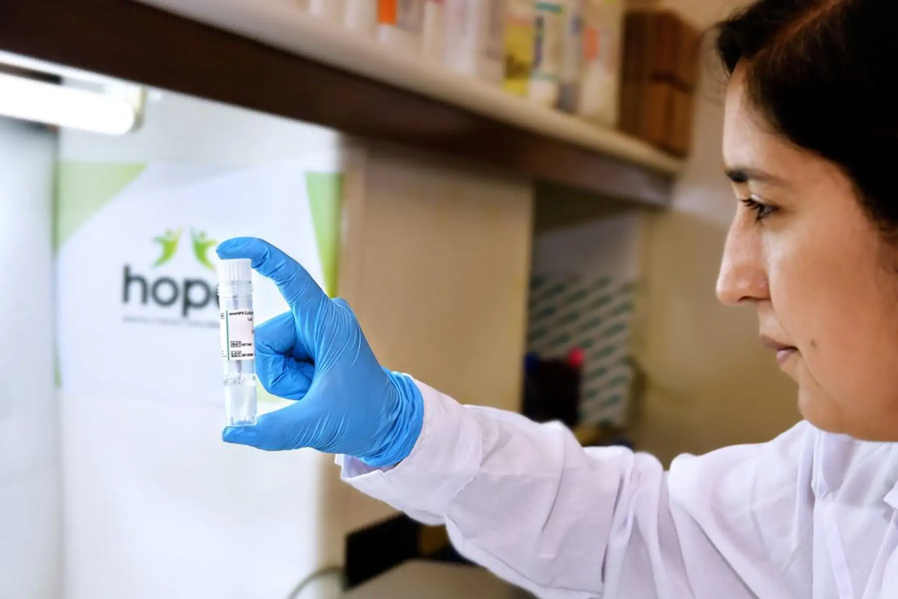 Se trata de una prueba molecular de bajo costo implementada por investigadores de la UPCH