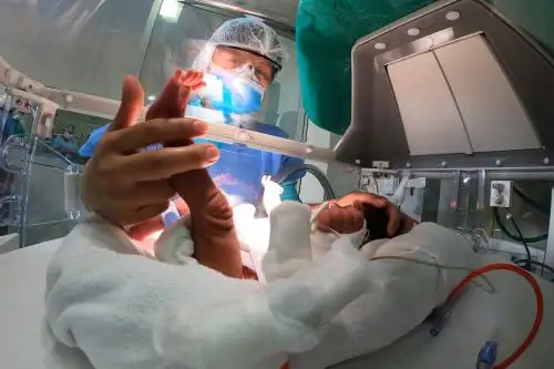 Abyhss trajo al mundo a trillizas, pero solo logró sobrevivir “Lucerito”, quien se recupera satisfactoriamente, al igual que los gemelos de Diana Katherine, “Vasco y Sebastián”. Por su parte, “Chesca” se encuentra en UCI neonatal desde hace 3 meses y su mamá le deja diariamente leche materna en el lactario institucional del Hospital Alberto Sabogal del Seguro Social. Foto: ANDINA/EsSalud.
