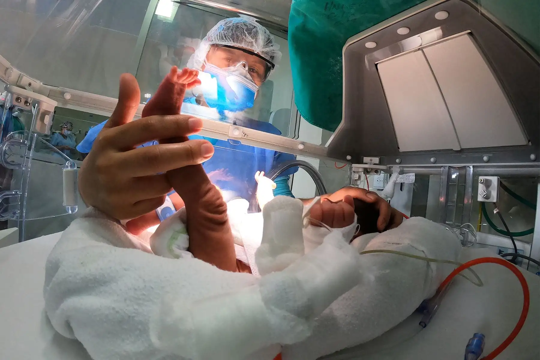 Abyhss trajo al mundo a trillizas, pero solo logró sobrevivir “Lucerito”, quien se recupera satisfactoriamente, al igual que los gemelos de Diana Katherine, “Vasco y Sebastián”. Por su parte, “Chesca” se encuentra en UCI neonatal desde hace 3 meses y su mamá le deja diariamente leche materna en el lactario institucional del Hospital Alberto Sabogal del Seguro Social. Foto: ANDINA/EsSalud.