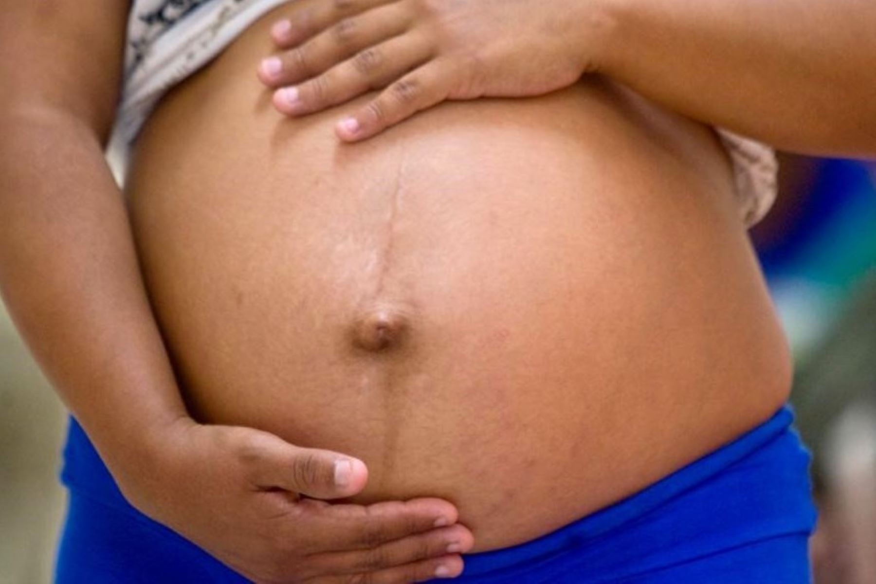 La anemia durante el embarazo aumenta riesgo de nacimiento prematuro. Foto: ANDINA/Difusión.