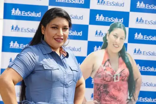 Nutricionista implementó nueva estrategia para que personas con obesidad logren bajar de peso de manera saludable y segura. Foto: ANDINA/EsSalud