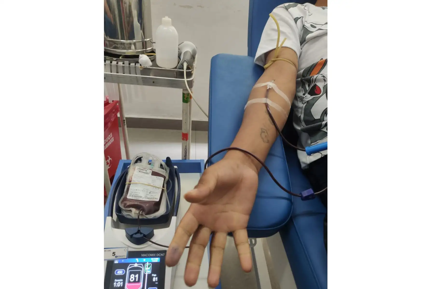 Para donar sangre es necesario cumplir con los siguientes requisitos básicos: tener entre 18 y 55 años, pesar más de 55 kilos, gozar de buena salud y no estar gestando o dando de lactar. Foto: ANDINA/srchivo.