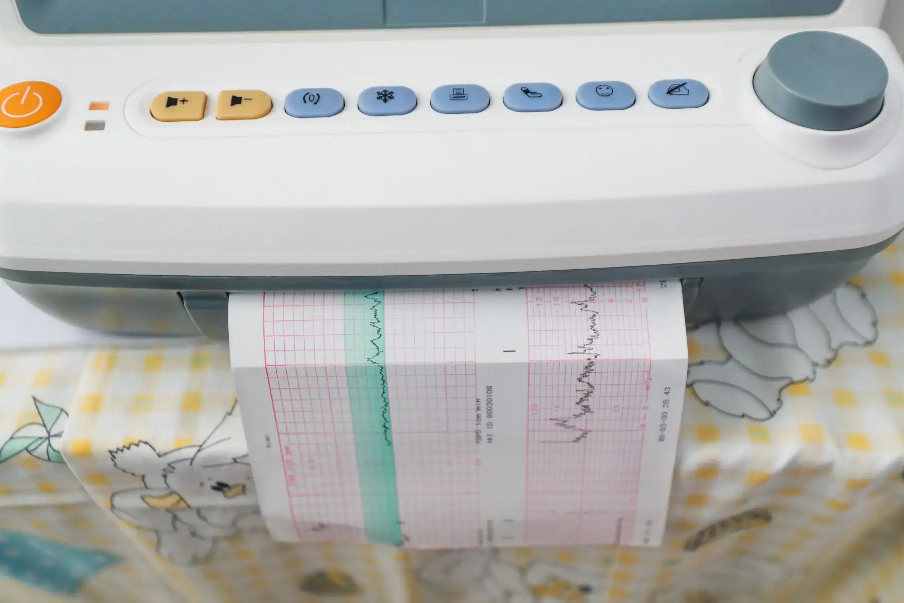 El Centro Materno Infantil San Fernando inaugura el Área de Monitoreo Fetal Electrónico, en el marco del fortalecimiento de la atención prenatal reenfocada y de la red de referencias para atención de parto, la cual beneficiará a más de dos mil gestantes. Foto: ANDINA/Carla Patiño