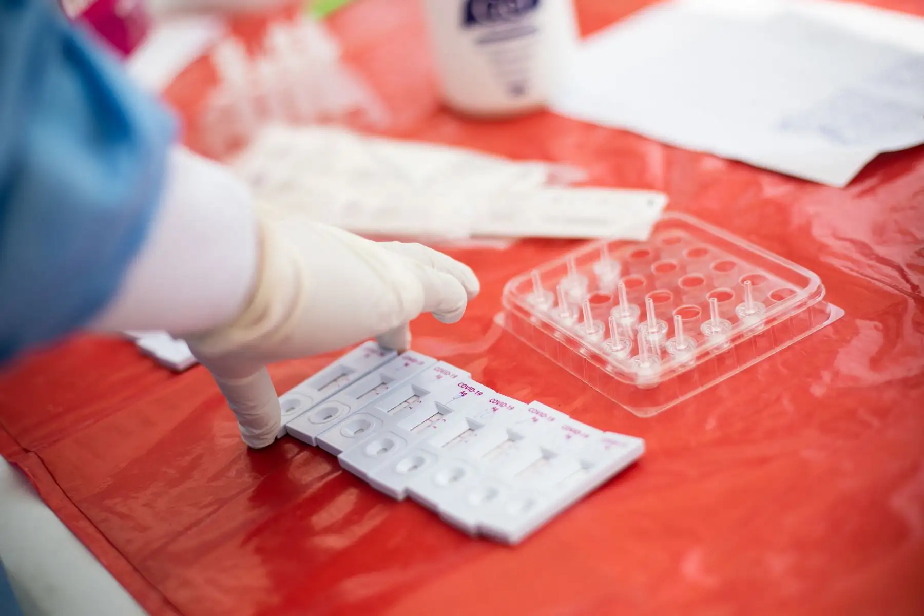 Campaña de salud preventiva Lima Te Cuida realiza pruebas de descarte Covid-19 a los pobladores de AAHH Nueva Caja de Agua. Además, este programa busca acercar los servicios de salud a la población más vulnerable de la capital e identificar las comorbilidades asociadas al COVID-19, como obesidad, diabetes e hipertensión. Foto: ANDINA/Municipalidad de Lima