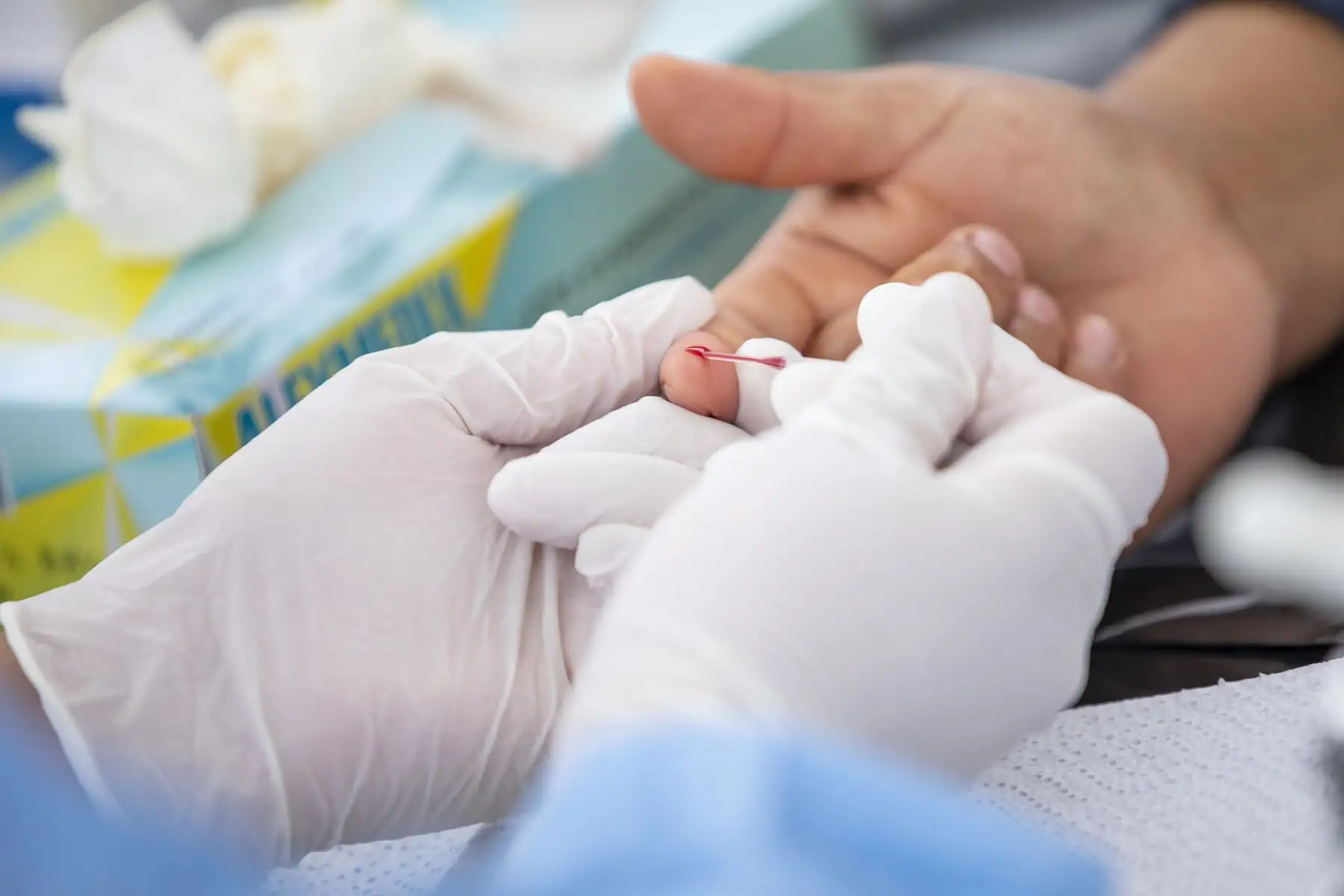 La Municipalidad de Lima a través de Sisol Salud, llevó la campaña Lima Te Cuida a Comas, donde realizaron descartes de covid-19 y otros servicios de salud. Foto: MML