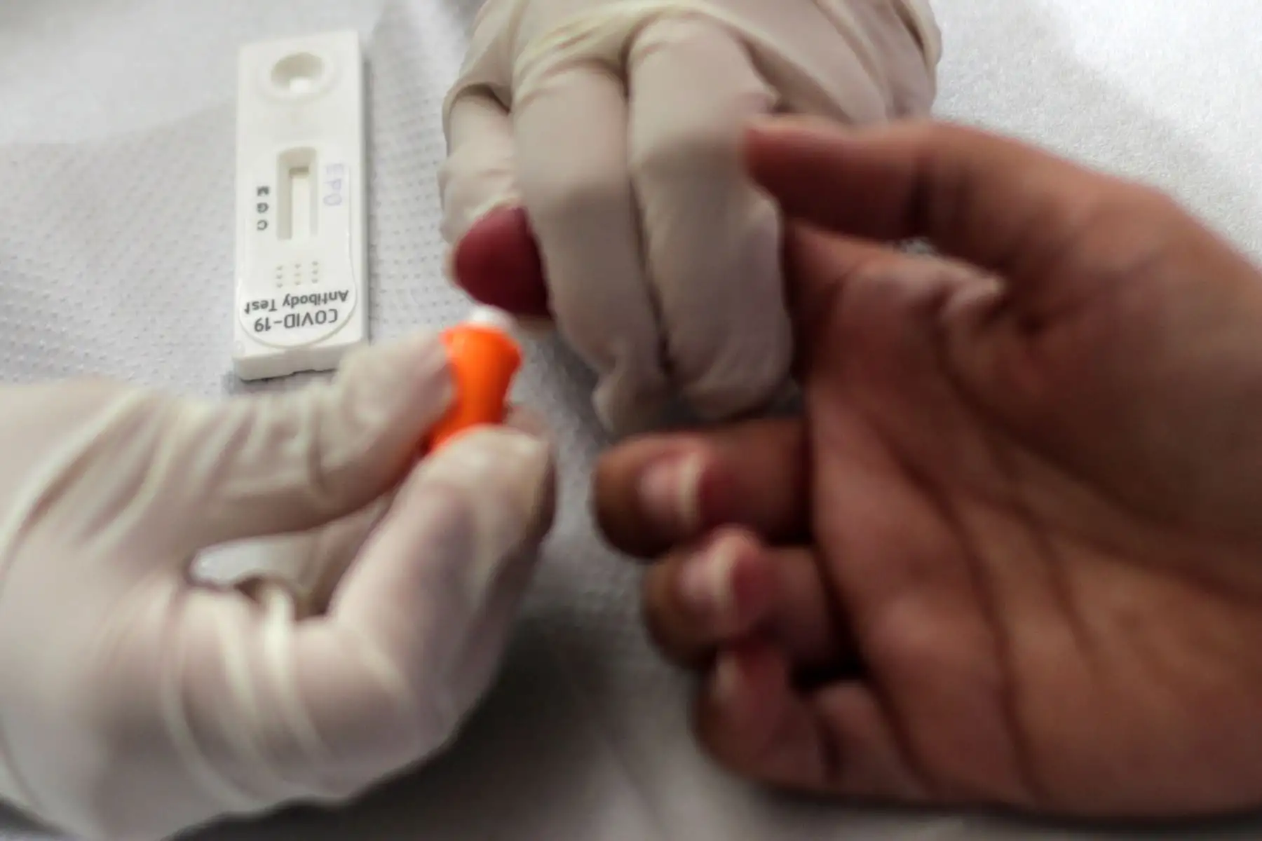 Una mujer realiza un examen de sangre para el diagnóstico de la Covid-19, en un puesto de salud de la ciudad de Río de Janeiro. Brasil, uno de los países más azotados del mundo por la pandemia de coronavirus junto con Estados Unidos e India, alcanzó hoy los 243.457 muertos y los 10.030.626 casos acumulados desde que se registró el primer contagio, hace casi un año. EFE/