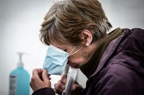 Un total de 527 participantes perdieron el sentido del gusto durante la enfermedad inicial; de este grupo, 200 personas (38 %) aseguraron que todavía no habían recuperado el sentido del gusto cinco meses después. Foto: AFP