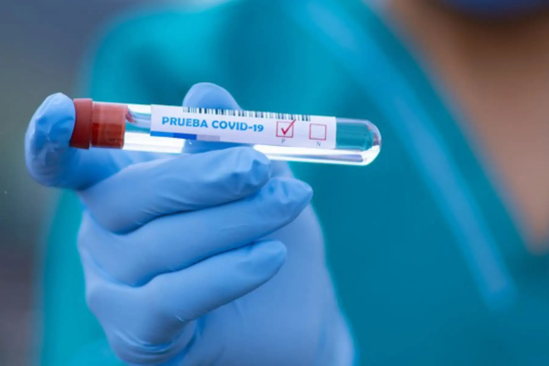 Perú Compras adquirirá 500,000 kits de detección molecular del covid-19. Foto: ANDINA/Difusión