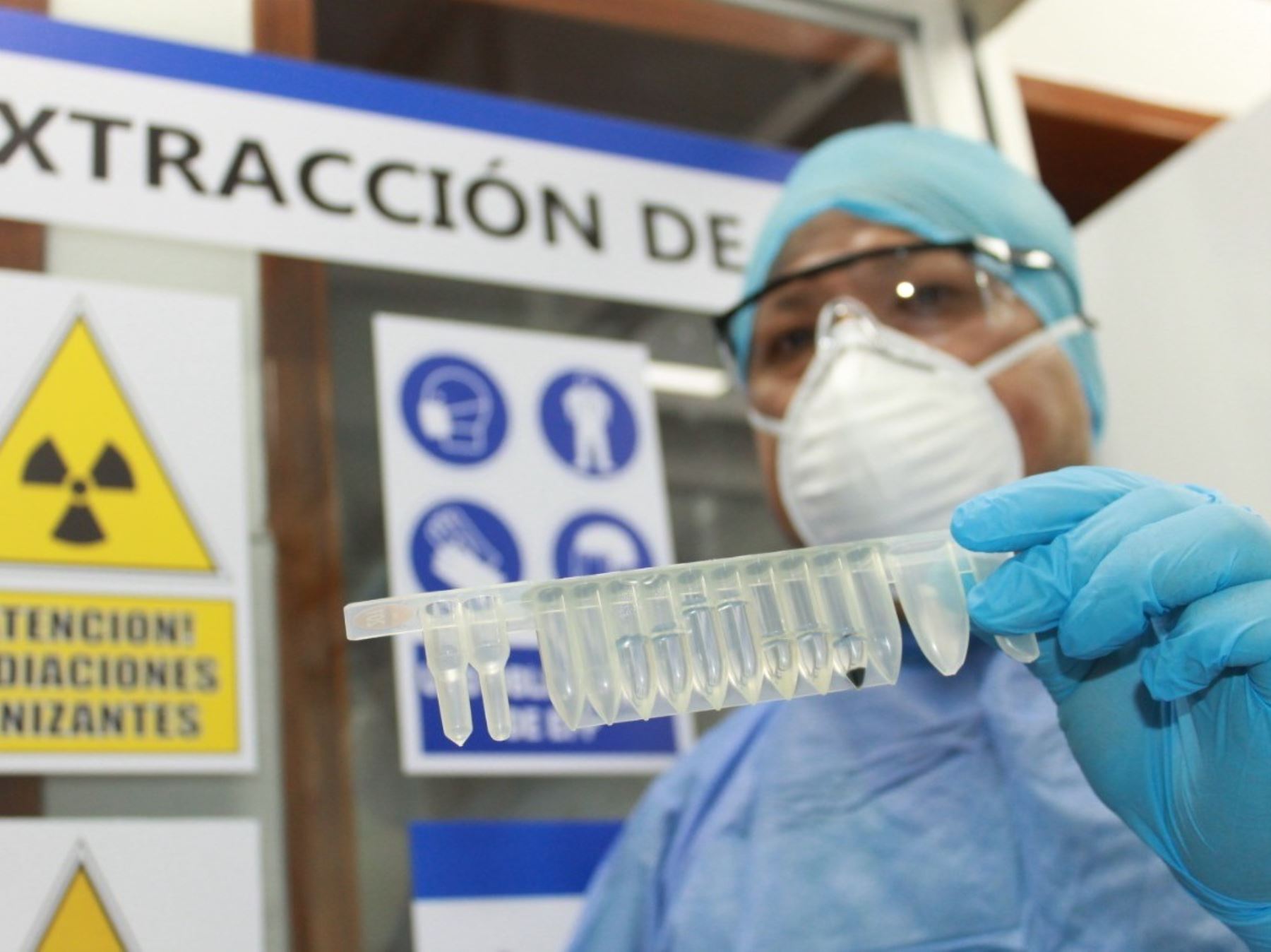 EsSalud pone en marcha en Cusco un nuevo laboratorio de biología molecular que permitirá procesar hasta 200 pruebas de covid-19 al día.