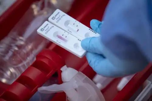 Hasta las 22:00 horas del miércoles 24 de junio se procesaron 13 millones 992,580 muestras moleculares, antigénicas y serológicas para el descarte de coronavirus. ANDINA / Andina