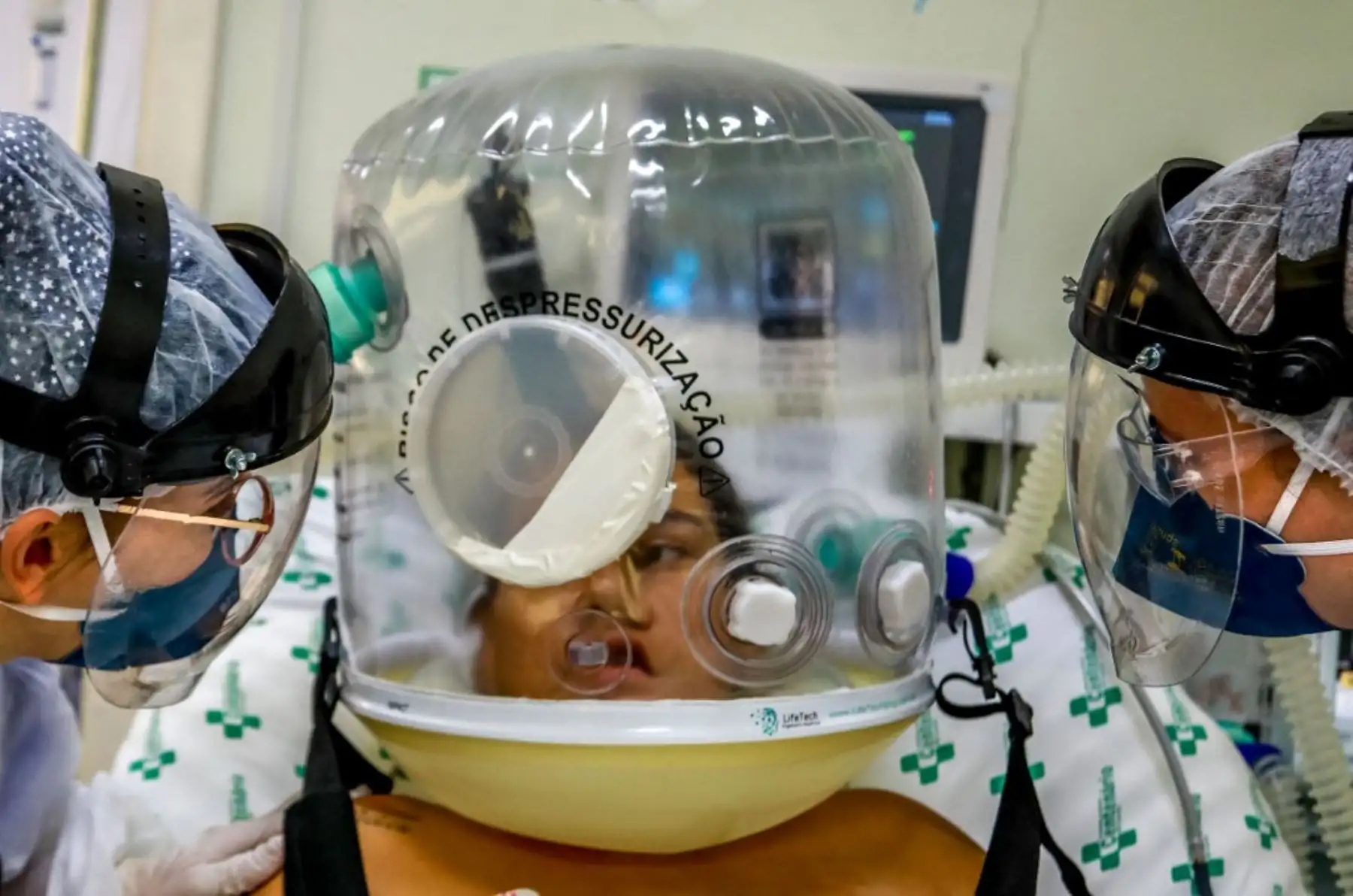 Un paciente utiliza una nueva tecnología no invasiva que puede reducir la necesidad de intubación en el área covid-19 del Hospital Centenario en Sao Leopoldo, estado de Rio Grande do Sul, sur de Brasil. Foto: AFP