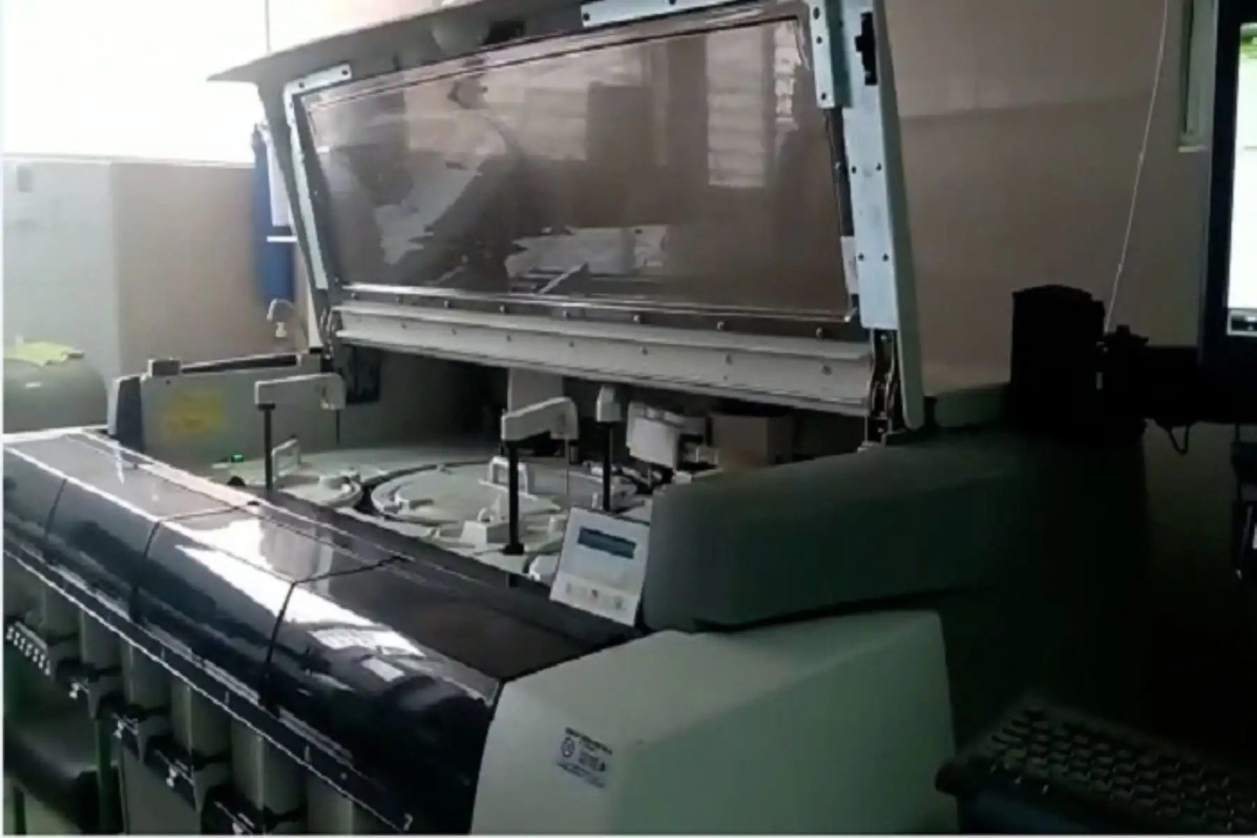 Estos equipos son capaces de procesar pruebas de bioquímica, hormonas e inmunología de manera automatizada y en línea con el sistema informático del servicio de Patología Clínica, lo cual acelera el tiempo para la entrega de los resultados hasta en un 50%.