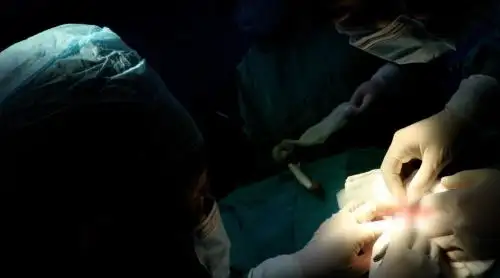 Una familia piurana tuvo un bello gesto de amor al prójimo al autorizar la donación multiorgánica de uno de sus seres queridos, un hombre de 57 años que lamentablemente perdió la vida en un accidente de tránsito.