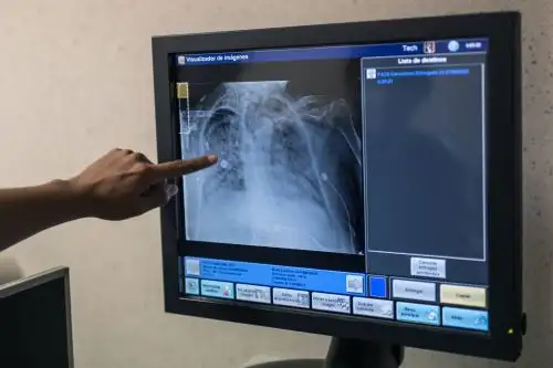 Las infecciones por covid-19, las hospitalizaciones y las muertes están disminuyendo en la mayor parte del continente, incluso en Brasil, Perú, Uruguay y Chile. Foto: AFP.