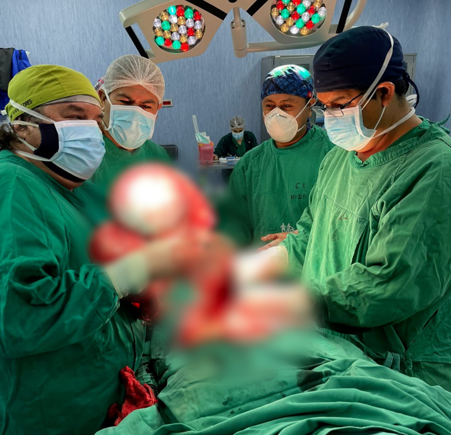 La Libertad:cirujanos de Hospital Virgen de la Puerta extirpan con éxito tumor de 15 kilos