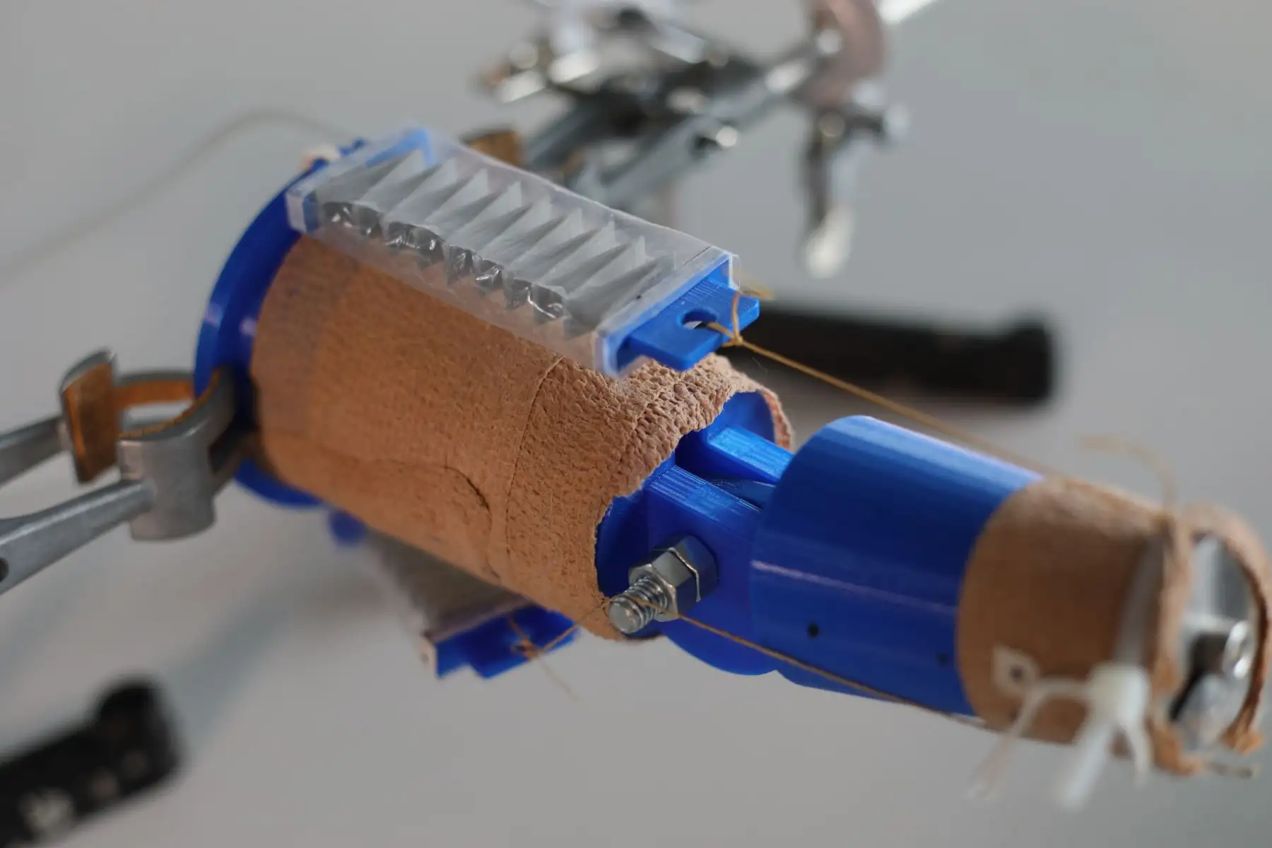 La espina bífida es una malformación congénita del tubo neural, que consiste en un cierre incompleto de la columna vertebral, padecimiento que deja en discapacidad a la persona desde su nacimiento. Foto: UTEC