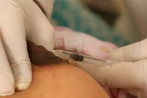 La primera leche que produce una madre cuando inicia la lactancia contiene inmunoglobulinas y ferritina que actúa como la primera vacuna para el recién nacido. Foto: ANDINA/Minsa