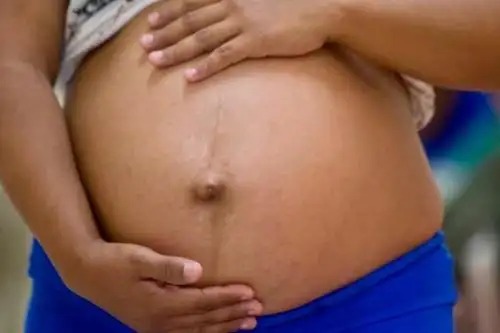 Minsa explica que a pesar de la disminución, se observa una brecha marcada entre el embarazo en adolescentes de la zona urbana, cuyo porcentaje es de 6.9%, y la zona rural, que es de 12.4%. ANDINA/ Minsa