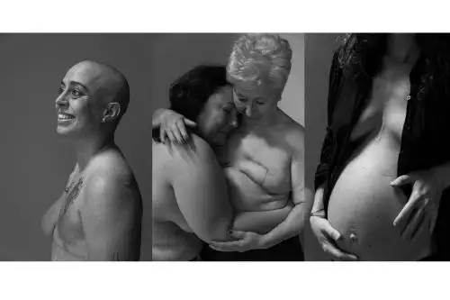 Exposición fotográfica “Cicatrices” abrirá sus puertas el 20 de diciembre en Barranco. Fotos: Cortesía de Claudia Quintana.