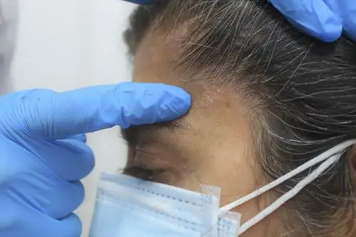 EsSalud advierte incremento de psoriasis por estrés durante la pandemia de covid-19. Foto: ANDINA/Difusión.
