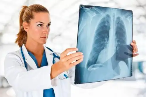 En abril de este año se publicó la Ley que declara de interés nacional la prevención, la detección temprana y el tratamiento del cáncer pulmonar. Foto: ANDINA/Minsa