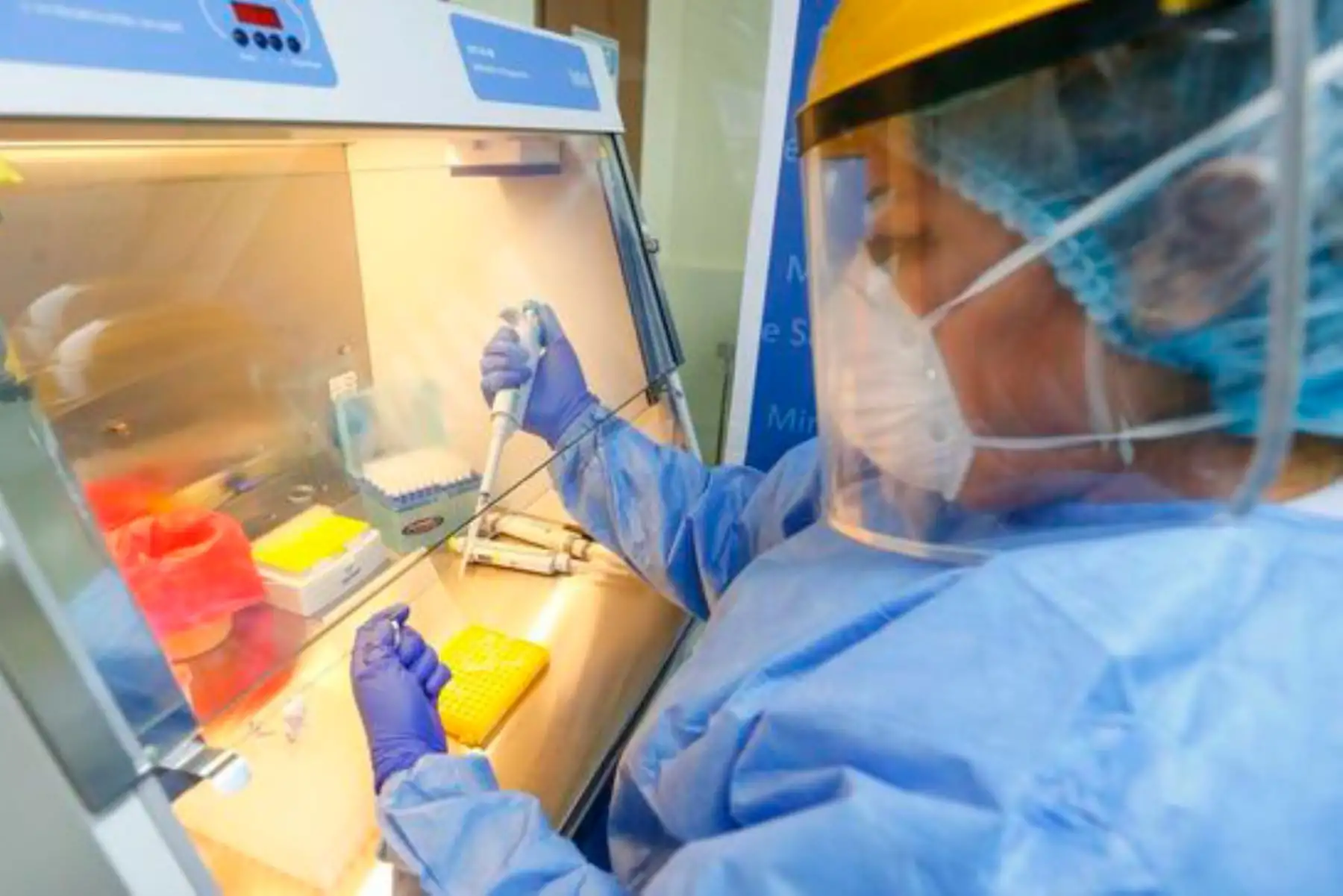 Es necesaria la detección para contribuir el control de la pandemia. Foto: ANDINA/INS