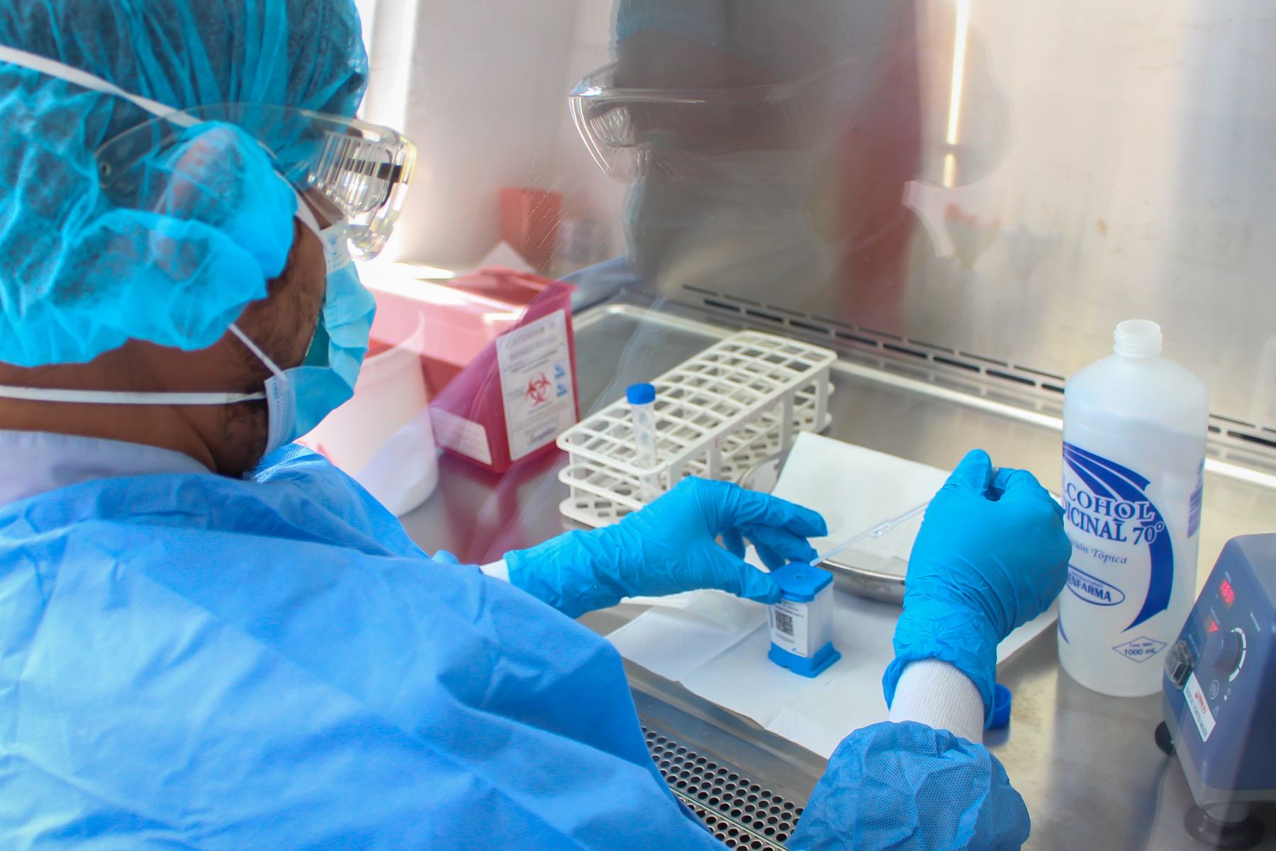 Hospital III Suárez Angamos procesará 500 pruebas moleculares al mes para detectar covid-19. Foto: ANDINA/Difusión