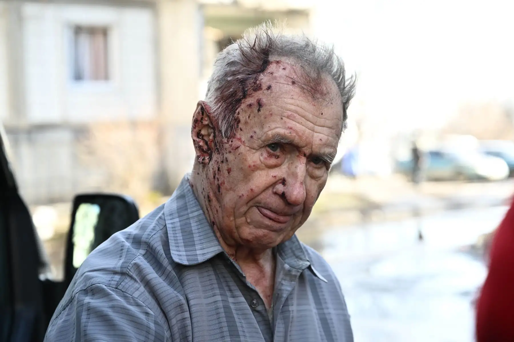 Un hombre herido se encuentra junto a un vehículo de una unidad de emergencia para recibir asistencia médica después de los bombardeos en la ciudad de Chuguiv, Ucrania. Foto: AFP